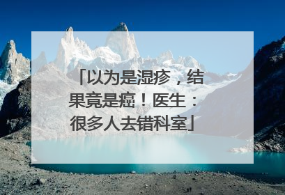 以为是湿疹，结果竟是癌！医生：很多人去错科室